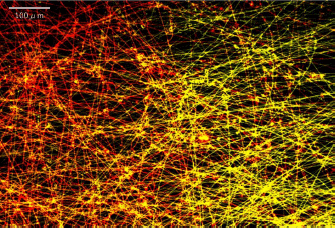 MM2 ナノポロック