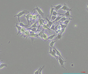UM5 アイノカタチ